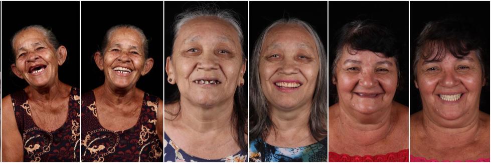 巴西牙医免费为数百人“换牙” 让他们重获自信