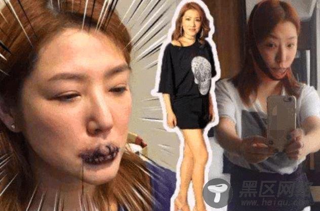 男友满天飞的“穆念慈”有多敬业？拍戏遭缝嘴